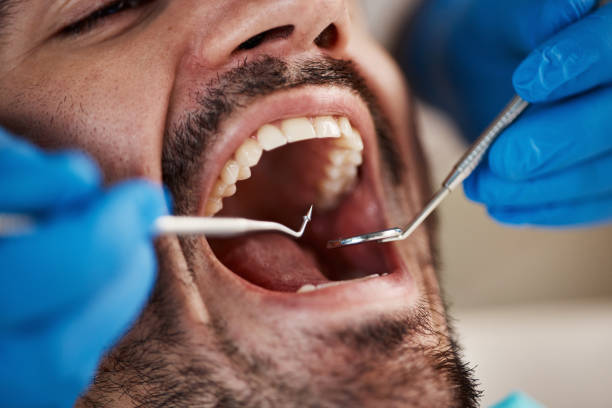 Best Emergency Broken Tooth Repair in Bargaintown, NJ